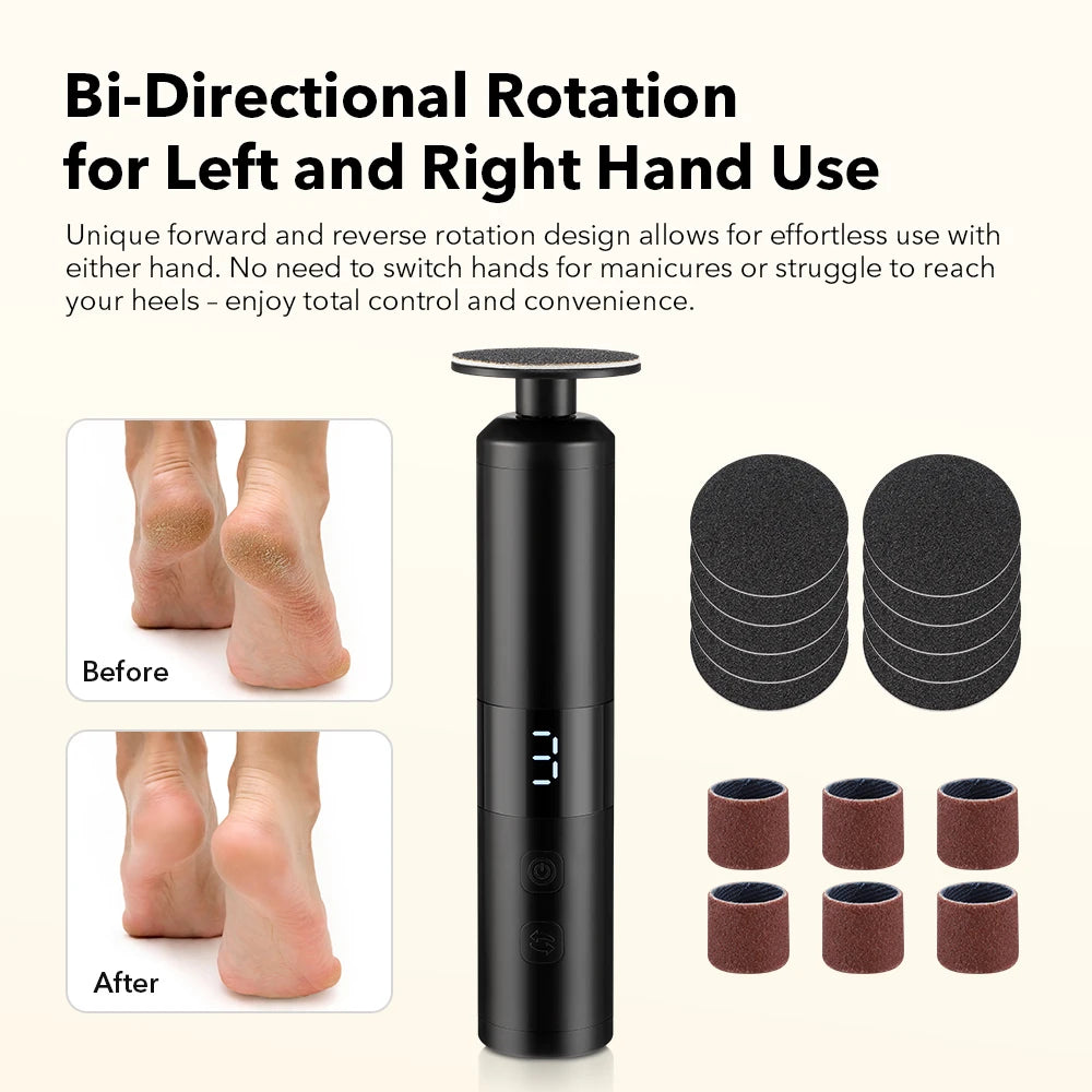 Lorairé™ Pro Electric Foot Callus Remover